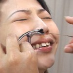 耳鼻科の女